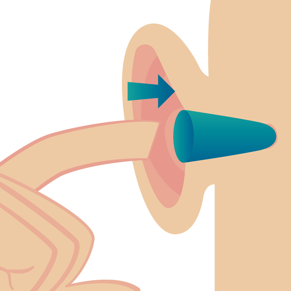 Illustration de la vérification de la position des bouchons d'oreilles jetables modulables 